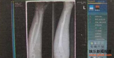 �����ɵ�������13������ ����ֱ������թǮ